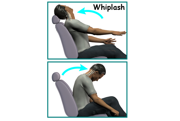Whiplash
