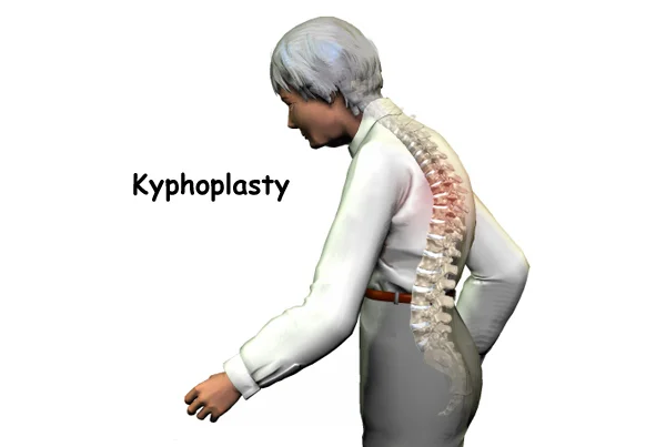 Mid Back